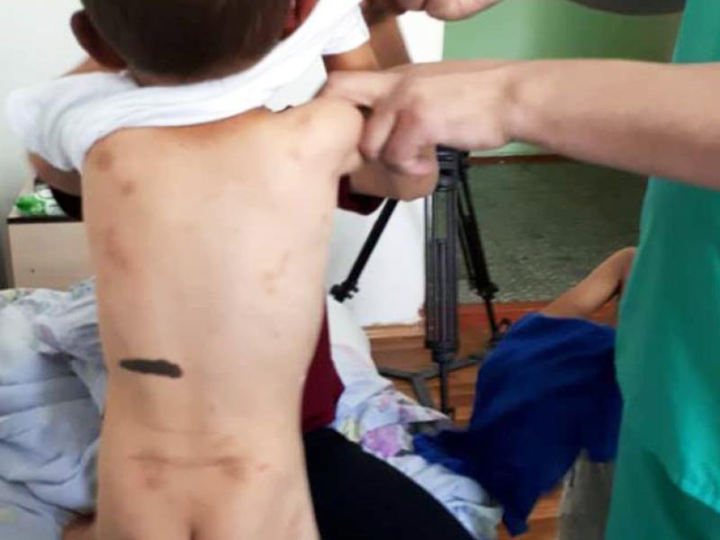 Уполномоченный представитель Акыйкатчы выехала в с. Сокулук, где мужчина избил свою жену и двух ее несовершеннолетних детей